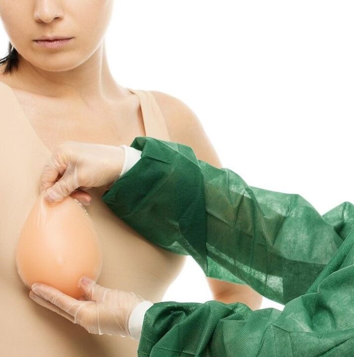 импланти за уголемяване на гърди